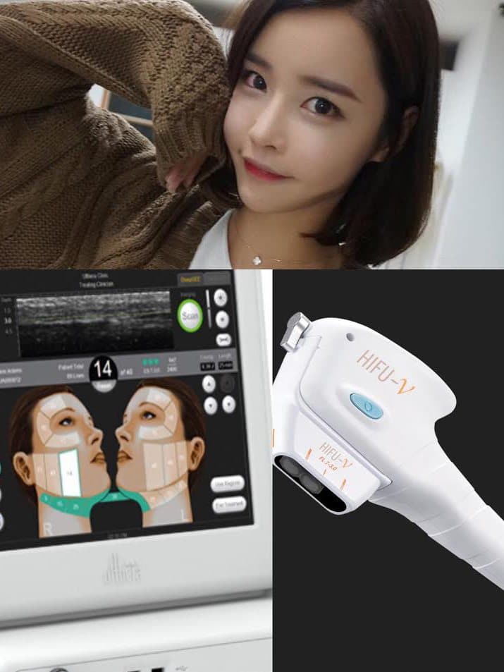 編輯教你揀！邊款醫美療程Hifu最work?