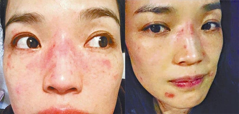 轉季敏感大爆發! 必狂搽這些高CP值抗敏產品