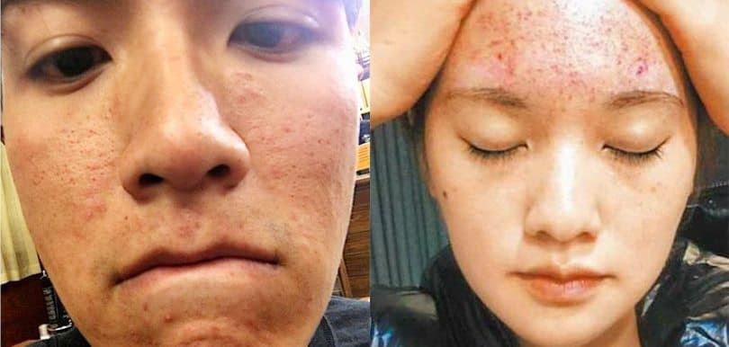 【3個你不知道的純天然護膚品牌】要注意敏感肌其實是亂塗出來的！