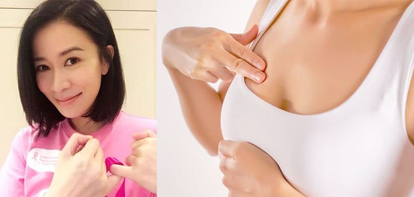 【乳癌4大謬誤】胸大就易患乳癌？