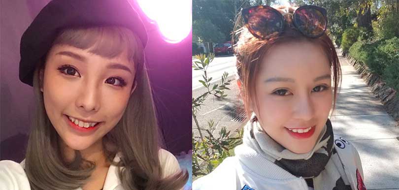 整容不歸路？兩位人氣KOL，大爆自己微整形經歷！