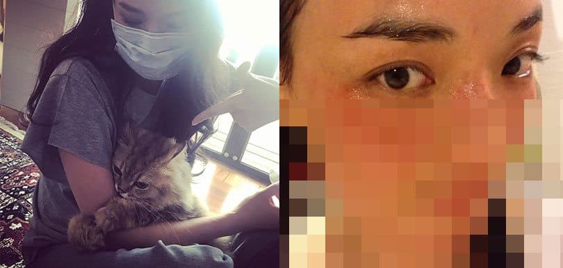 是懷孕了嗎？舒淇澄清因這個身體因素暫告影壇！冬天教你3招預防中招