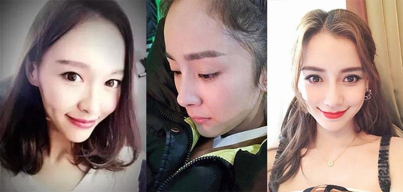 小強可改善脫髮問題？研究大發現！