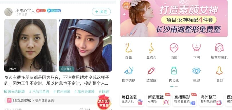 大量用家真實分享！大熱醫美整形APP分享整容日記