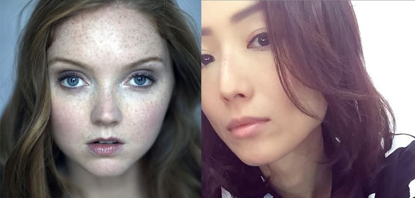 雀斑怎會等如醜化？盤點時尚界火紅的雀斑美人