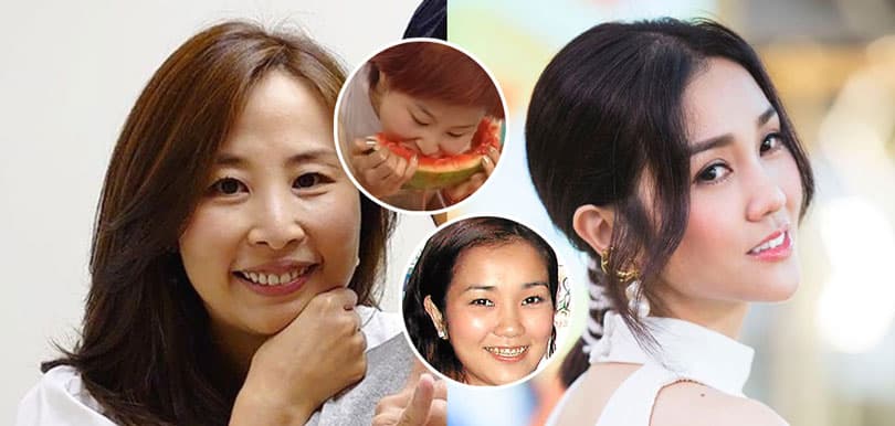 「西瓜刨」蘭茜箍牙後近照曝光！ 呢幾位女藝人箍牙後星途逆轉