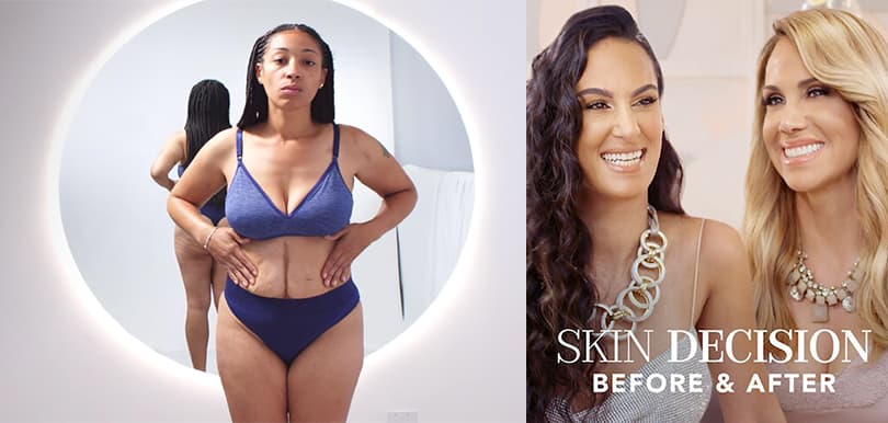【Netflix】全新整容真人騷《Skin Decision》！為槍傷女生除掉子彈孔 讓你了解整容背後的故事