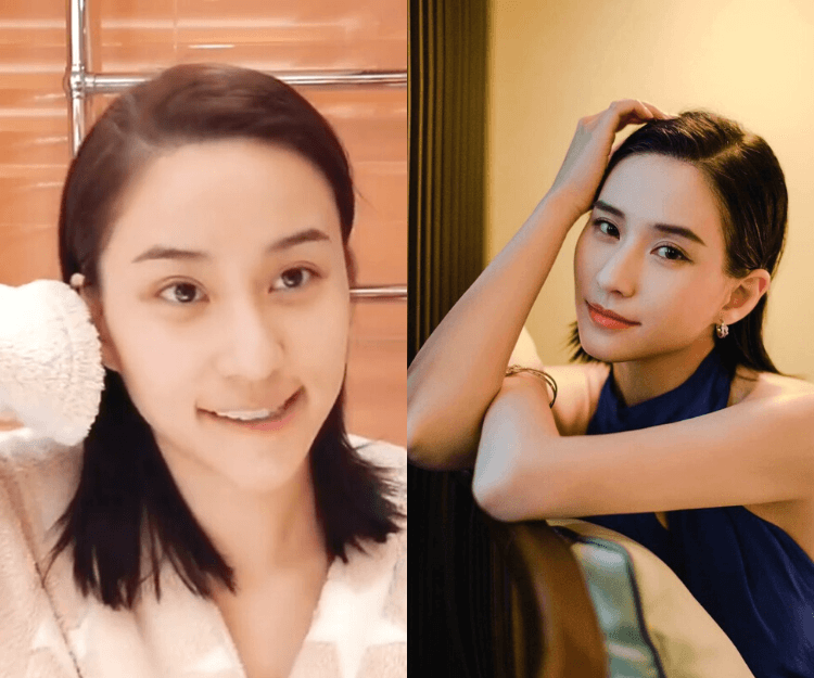 【醫學美容】何超蓮分享美容院護膚心得  最美千金竟然是醫美新手？