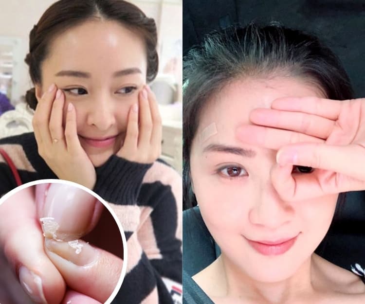 指甲直紋代表什麼？你可能不知道的7大指甲問題