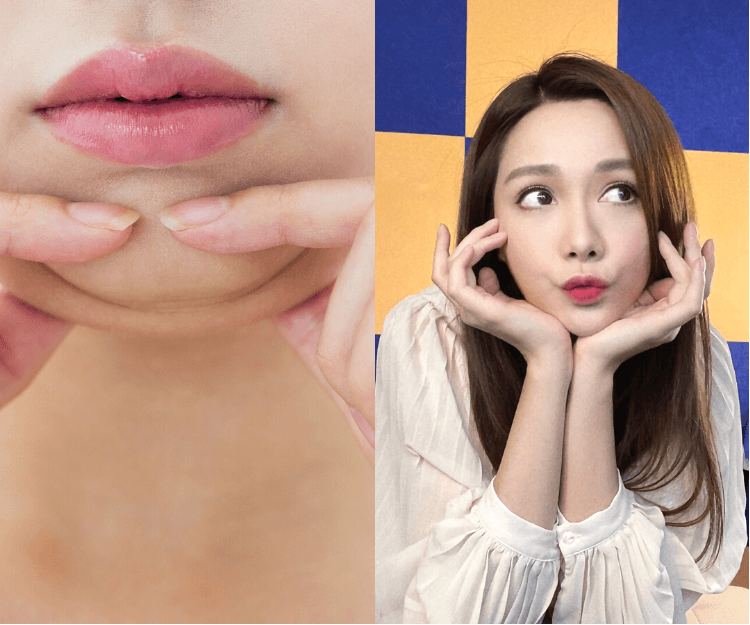 踢走包包面！教你自測面大3個原因 針對性瘦面方法｜醫學美容