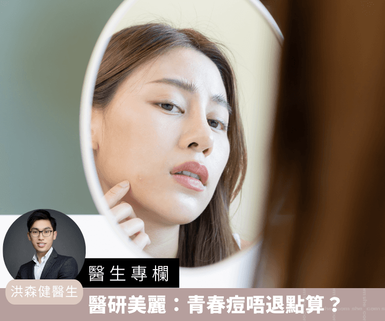 【醫生專欄】醫研美麗：青春痘唔退點算？