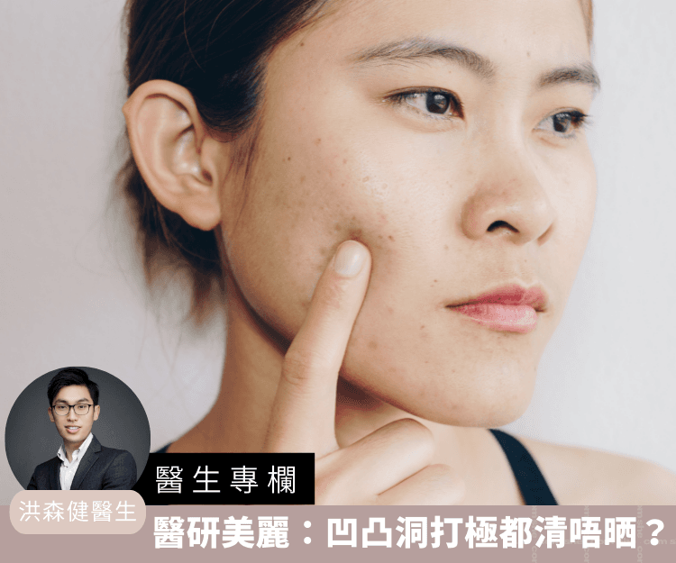 【醫生專欄】醫研美麗： 點解凹凸洞打極激光都清唔晒？