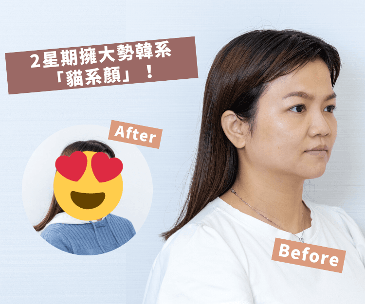 【素人改造大變身】2星期膠原Double UP！幼嫩澎潤感＋俐落鮮明下顎線：大勢「貓系顏」輕鬆GET！