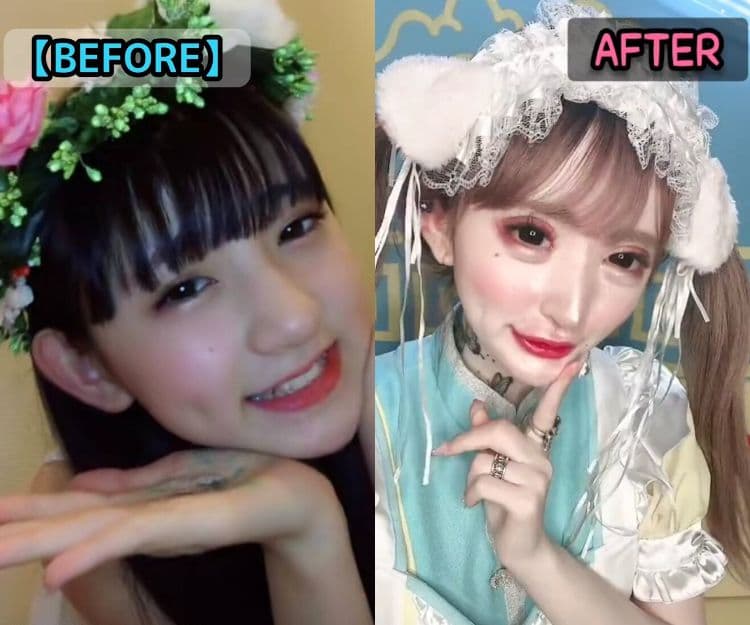 日本18歲少女整容上癮變「蛇精」？過去清純照曝光 網民：浪費了900萬日圓
