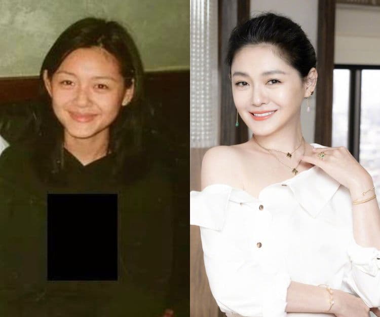 大S薄血藥美白｜徐熙媛美白搵命搏！老公具俊曄爆身體虛弱 網民猜測是美白後遺症？專家指出2大副作用