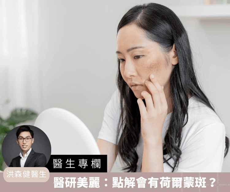 【醫生專欄】醫研美麗：點解會有荷爾蒙斑？
