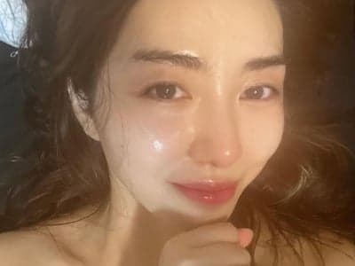 前AOA成員權珉娥做HIFU醫美療程致二級燒傷！一文了解HIFU原理、功效、風險及注意事項