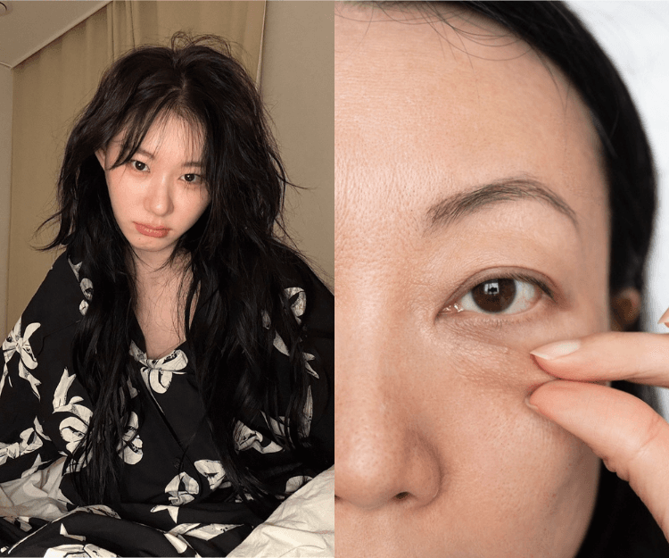 如何分辨3大類型眼袋？教你6招改善眼袋︰早晚眼霜功效各不同、水腫型眼袋避吃1類食物！什麼情況需要醫美去眼袋？