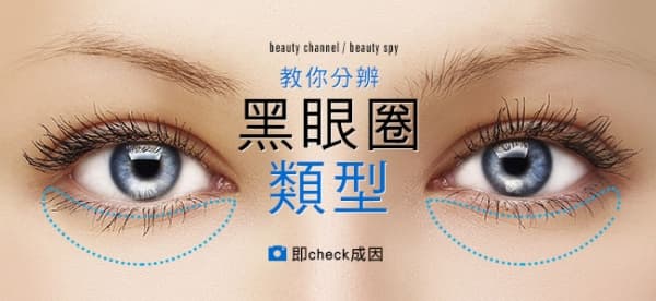 教你分辨黑眼圈類型