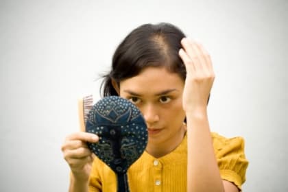 頭髮補品助改善女士脫髮