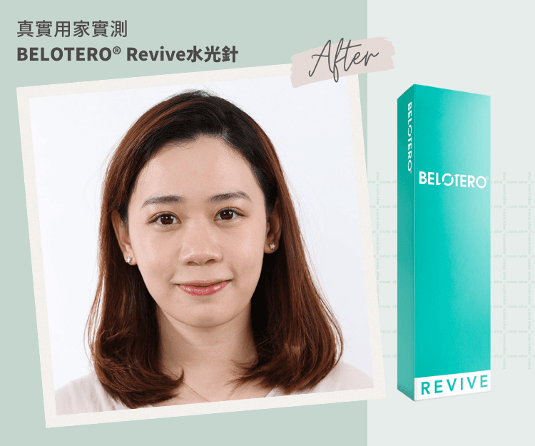 真實用家實測 | BELOTERO®️ Revive水光針深入肌底 全面膚質健康的秘密 水潤少女肌輕鬆get!